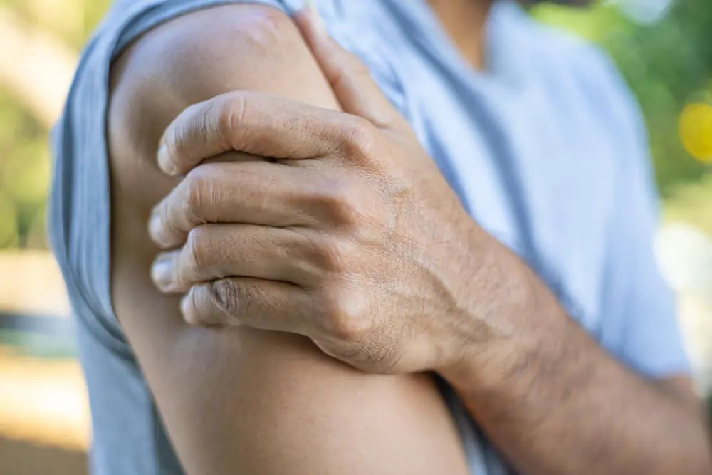 Psoriatic Arthritis