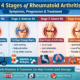 Detailed visual guide of rheumatoid arthritis stages from early inflammation to joint damage, symptoms, progression and modern treatment options