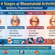 Detailed visual guide of rheumatoid arthritis stages from early inflammation to joint damage, symptoms, progression and modern treatment options