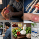 Man suffering from severe gout pain in swollen big toe with rheumatologist consultation, uric acid joint inflammation, healthy gout diet, and gout treatment concept.