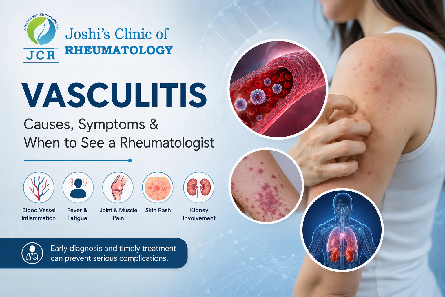 Vasculitis symptoms including skin rash, blood vessel inflammation, joint pain, fever, fatigue, and kidney involvement.